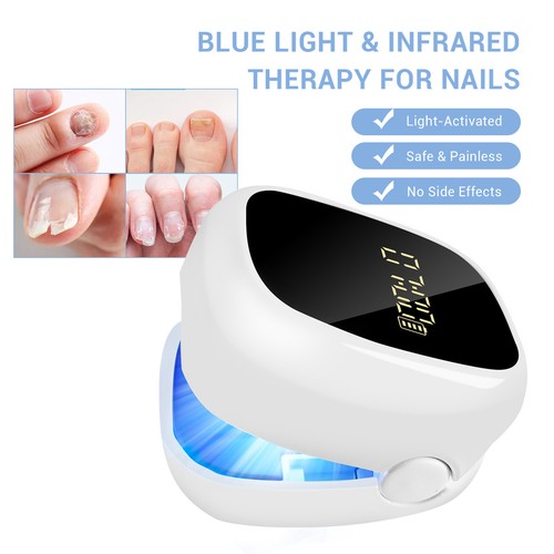Portable nail fungus - nail, light
