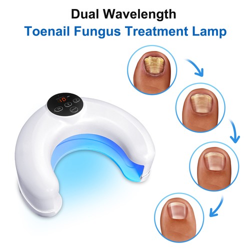 Nail fungus therapy - fungus,