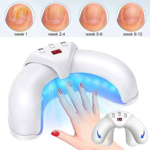 Fungal nail treatment light - nail,