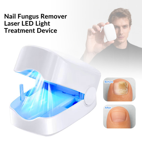 Light nail fungus laser - light,