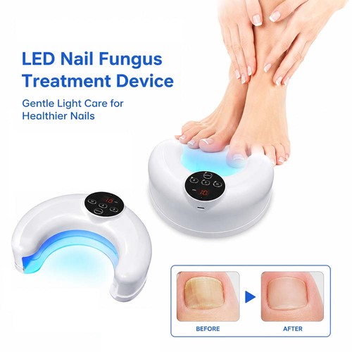 Dual wavelength nail fungus - nail,