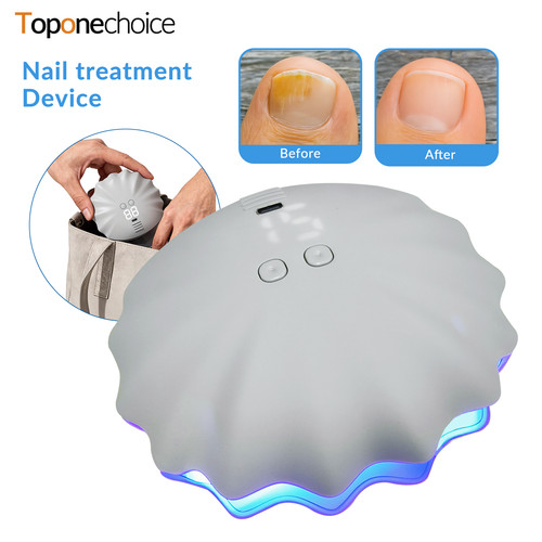 Home use nail fungus light - use,