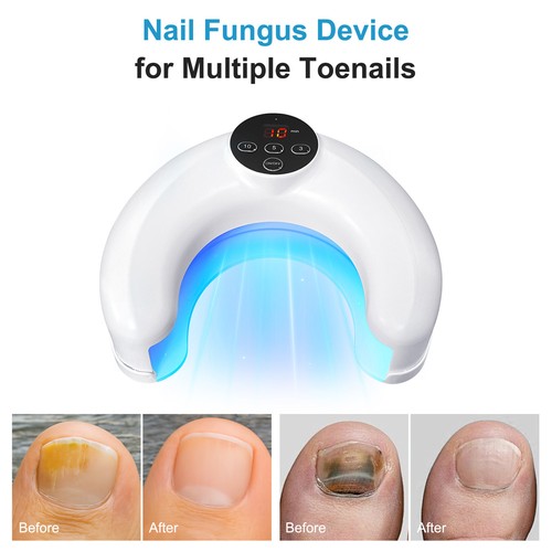 Led nail fungus - nail, lamp