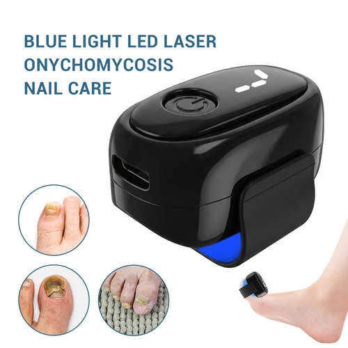Nail fungus light therapy - fungus,