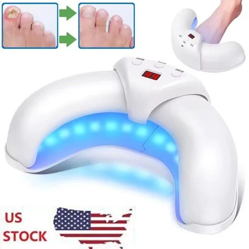 Nail fungus laser - laser,