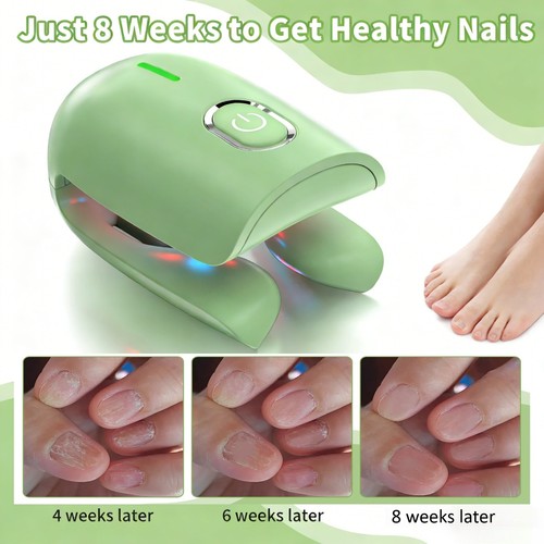 New nail fungus - new, device