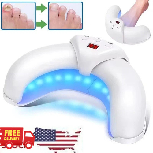 Nail fungus laser - laser,
