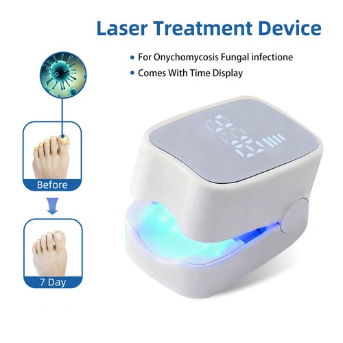 Nail fungus laser - fungus,