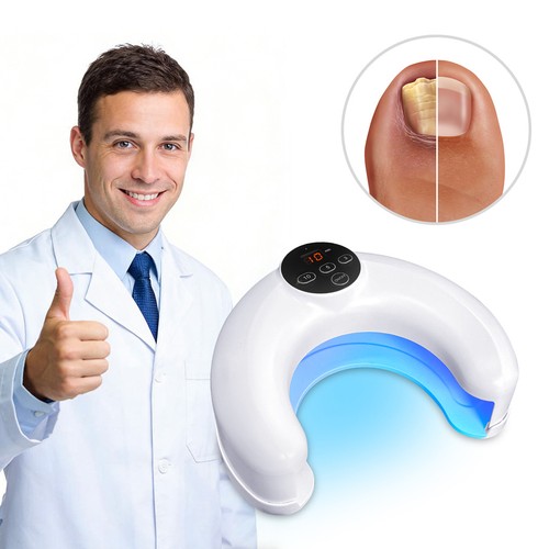 Led nail fungus - led, treatment