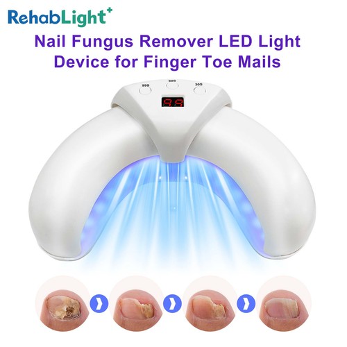 Nail fungus led light for - fungus,